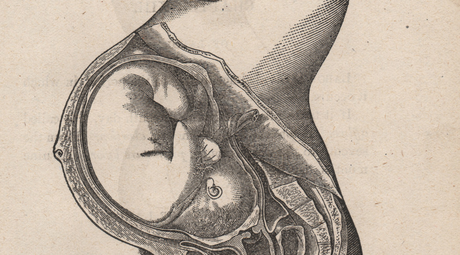 满月宝宝每天2点就哭闹不止,不是饿也不是病,