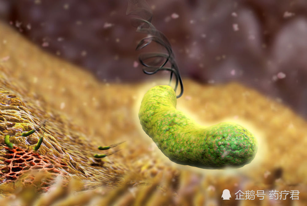 吃药根除了幽门螺旋杆菌,复发的危险性有多大