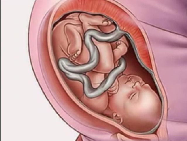 9个月的胎儿在妈妈肚子里的姿势是怎样的?胎儿的这些