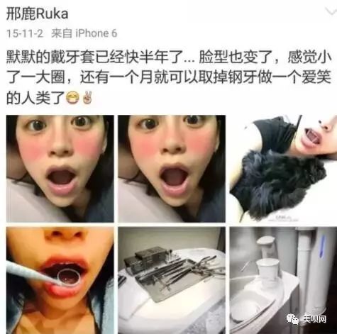 japonensisfes中国vedao