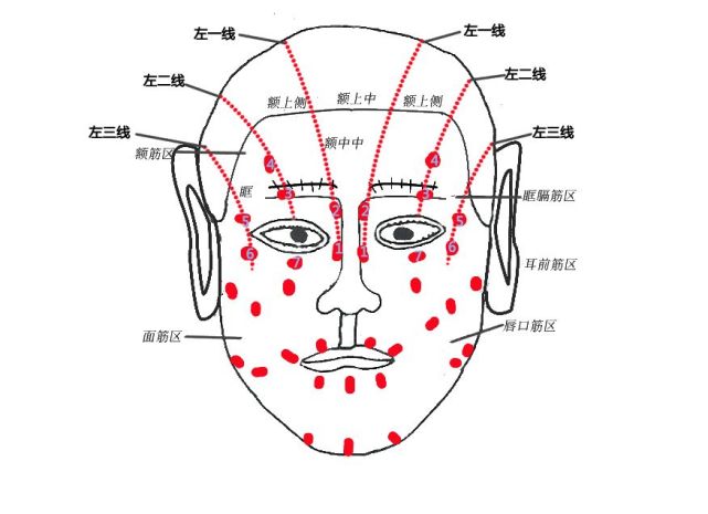 经筋【头,面部"筋结"病灶的检查及病灶分布图