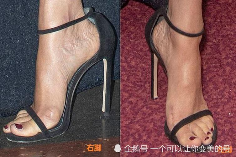 梅根挺大肚仍爱"恨天高",拇外翻鼓包明显,双腿光滑拒穿丝袜