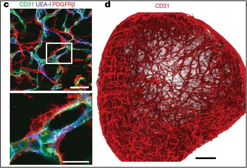 《自然》重磅:完美人体血管模型成破解糖尿病