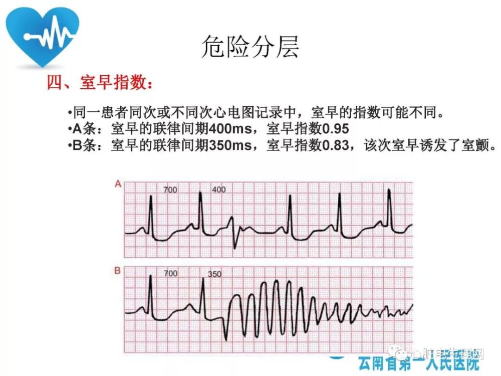 精彩课件丨室性早搏的危险分层及治疗策略