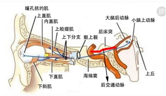 上支细小,支配上直肌和上睑提肌.下支粗大,支配下直,内直和下斜肌.