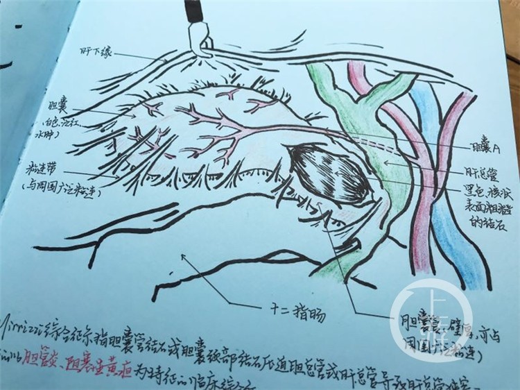 灵魂画手!实习医生手绘人体解剖图 让人惊掉下巴