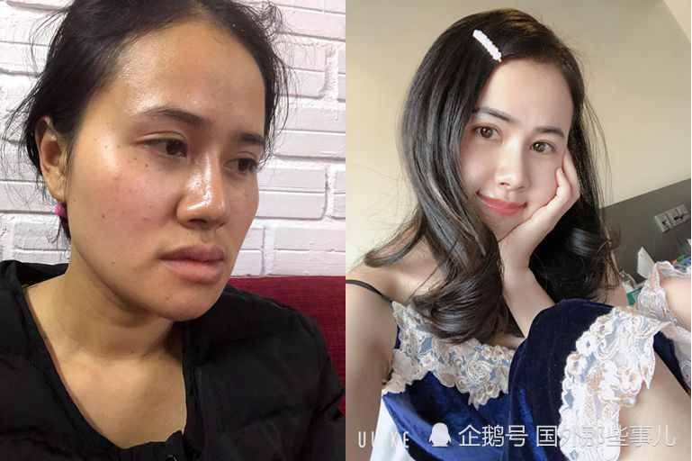 女子因太丑常被丈夫辱骂最终离婚 整容后又因太美走红