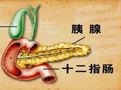 胰腺癌被称为癌中之王有三个原因,五类人是胰腺癌高危人群
