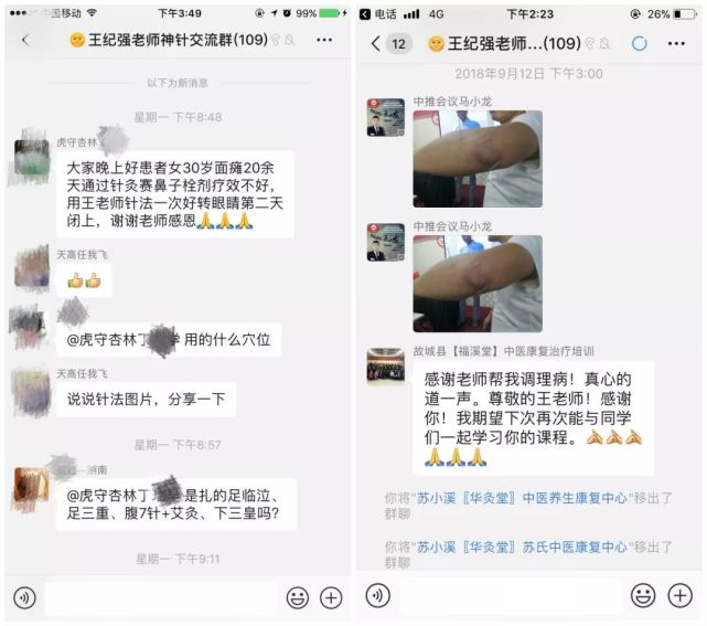 鲁西神针王纪强:针入痛止,酣畅淋漓,特效针灸!
