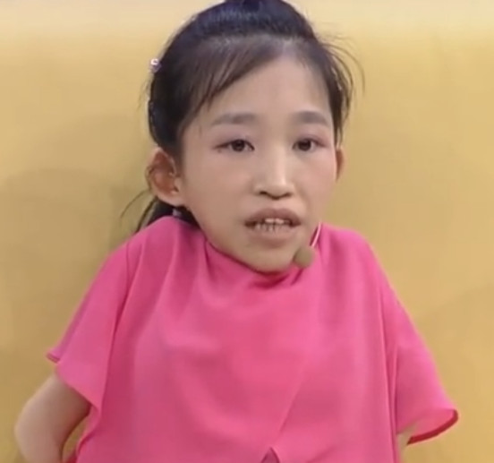 三姐妹患有瓷娃娃病症,55岁妈妈一出场,涂磊直呼:这么