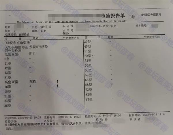 病例分享---宫颈同时检测出cin1到cin3不同程度病变,两次锥切依然在