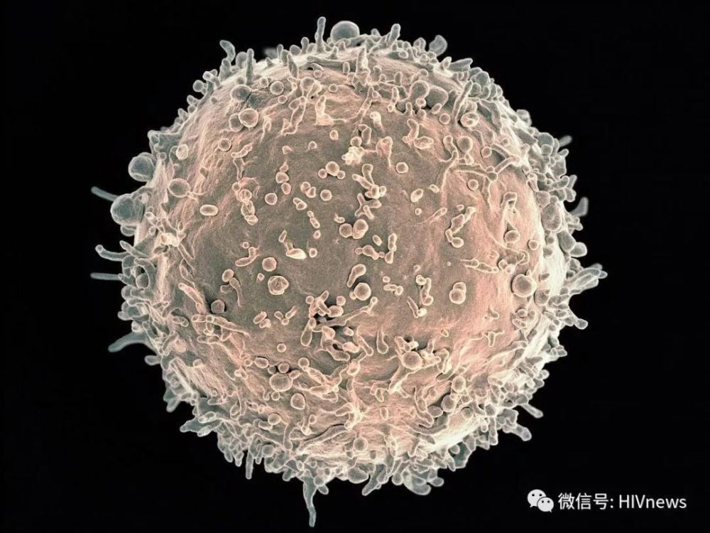 巨噬细胞是hiv病毒库的第一个证据,活化后产生感染性