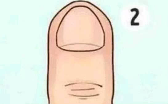 640