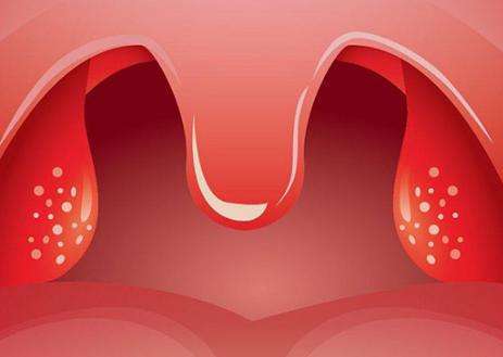 在咽后壁两侧如果能看到两块淡红色的肉,那就是扁桃体,如果它颜色发红