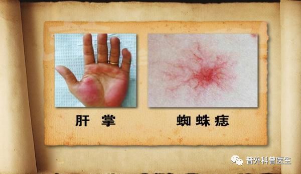 想要体检一下肝脏,应该挂什么科?做哪些检查?