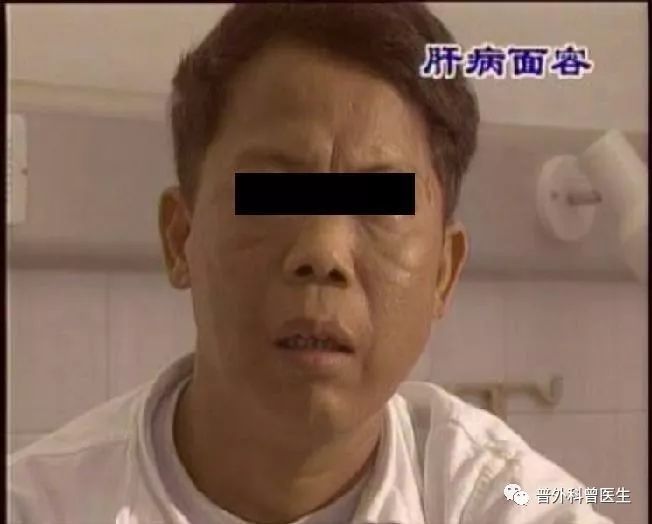 想要体检一下肝脏,应该挂什么科?做哪些检查?