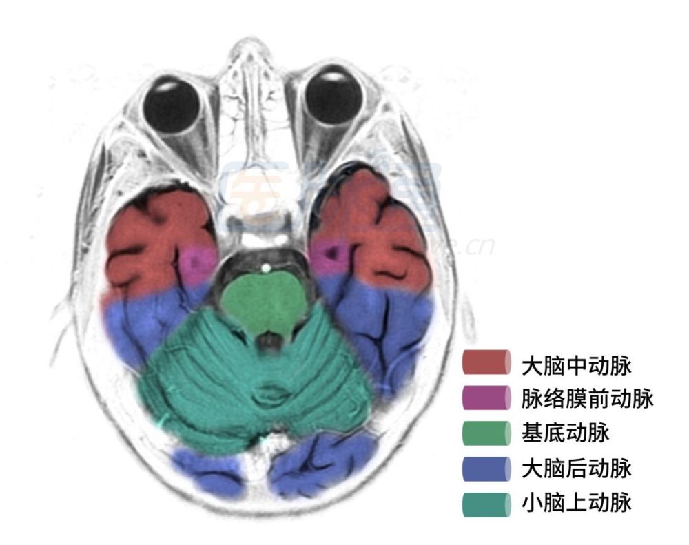 小脑前下动脉:供血小脑下部的前侧及脑桥下1/3,闭塞可引起桥脑基底