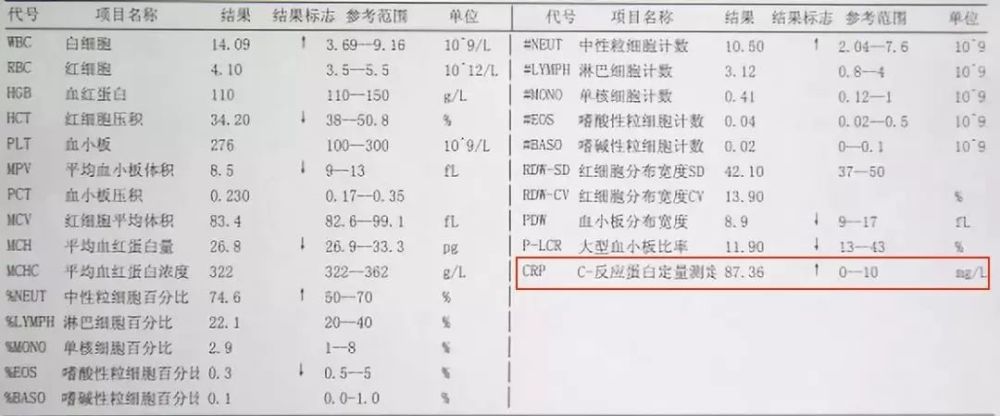 时候检查、发烧,儿童感冒周依性感美女血常规更a?图片