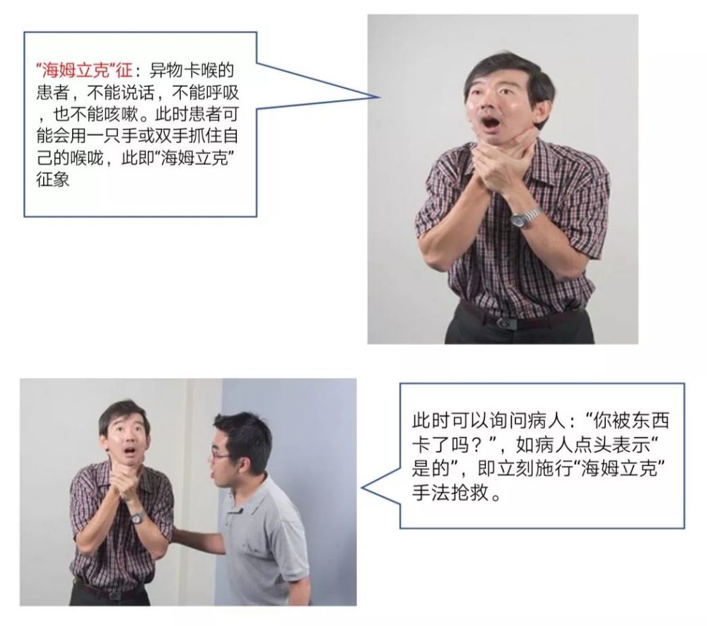 异物卡喉,实例救命教学!7秒救孩子一命!
