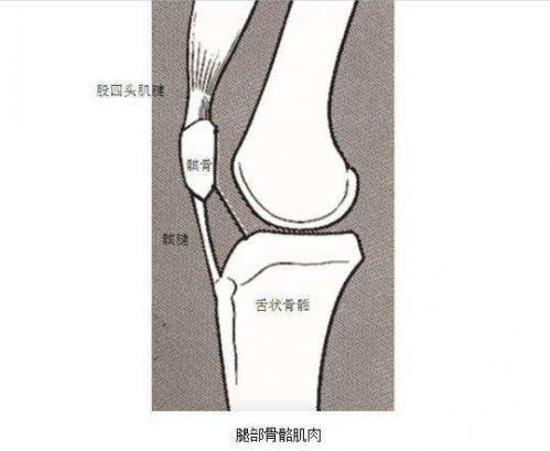 膝盖疼一定是生长痛?不,还有很常见的一个病,胫骨结节软骨炎
