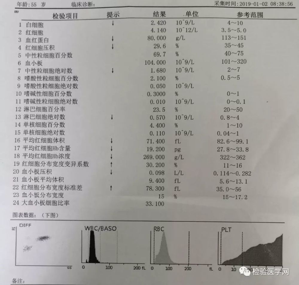 电阻抗法测血小板,血小板计数在正常参考范围内.