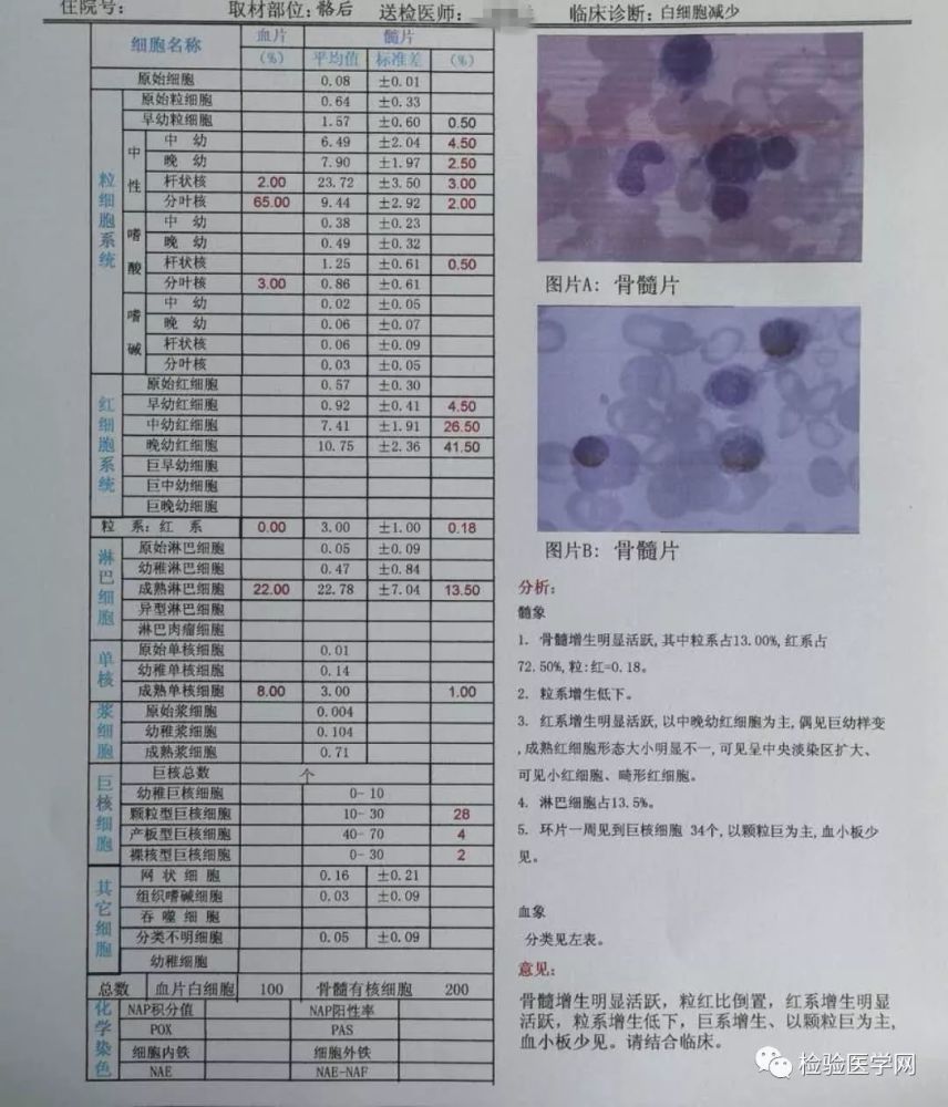 骨髓报告提示血小板少见,可见小红细胞,畸形红细胞.