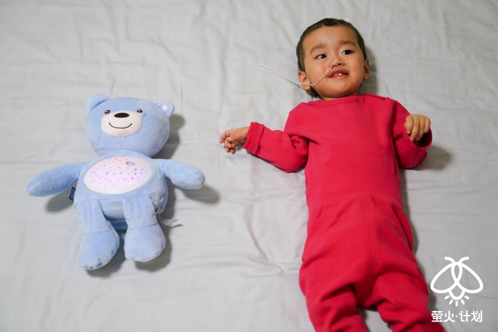 罕见病SMA患者:孩子通过鼻腔进食 不能