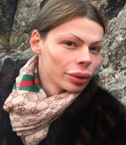 男子觉得自己是中性人,整容不男不女,整容上瘾在整容
