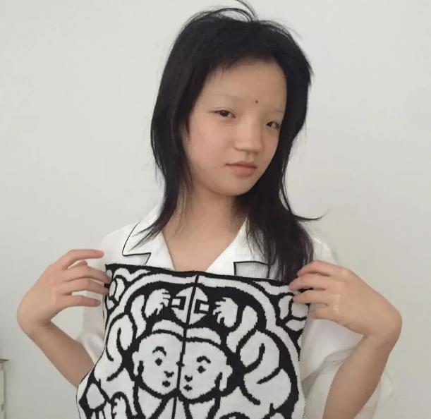温州女孩"畸形脸"被捧为超模,这张脸怎么看都像歧视中国人!
