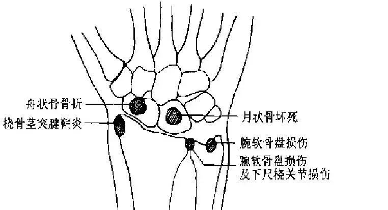 运动损伤检查及处理方法