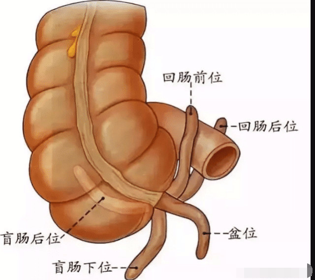 人体最"没用"十大器官,阑尾竟不是最该淘汰的