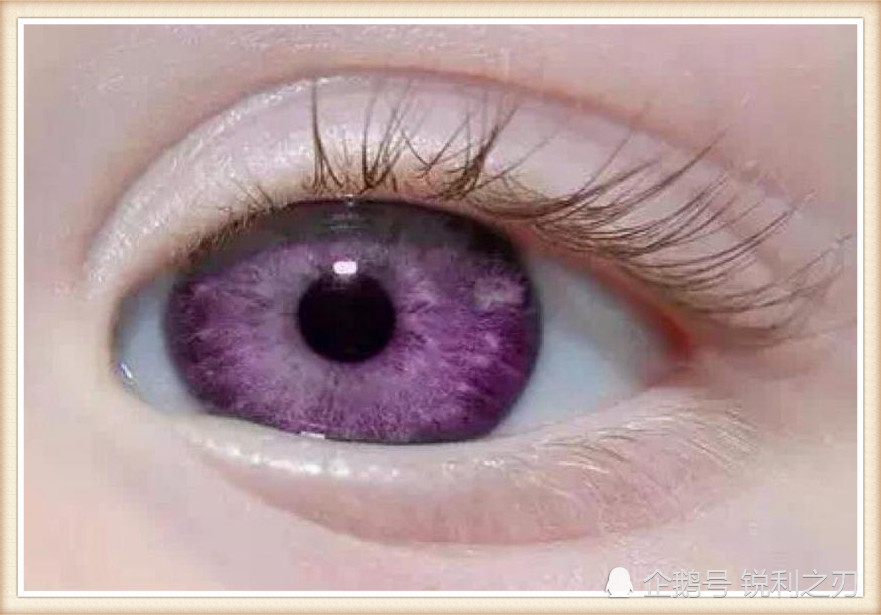 世界上最罕见瞳孔颜色,简直美到了极致,全球仅600多例!