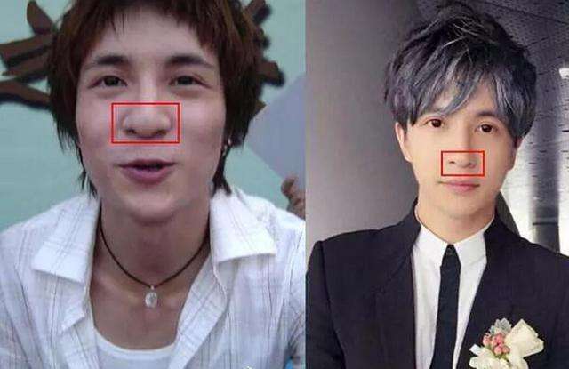公开承认整容的男星:胡歌让人心疼,华晨宇是整容最成功的一个!
