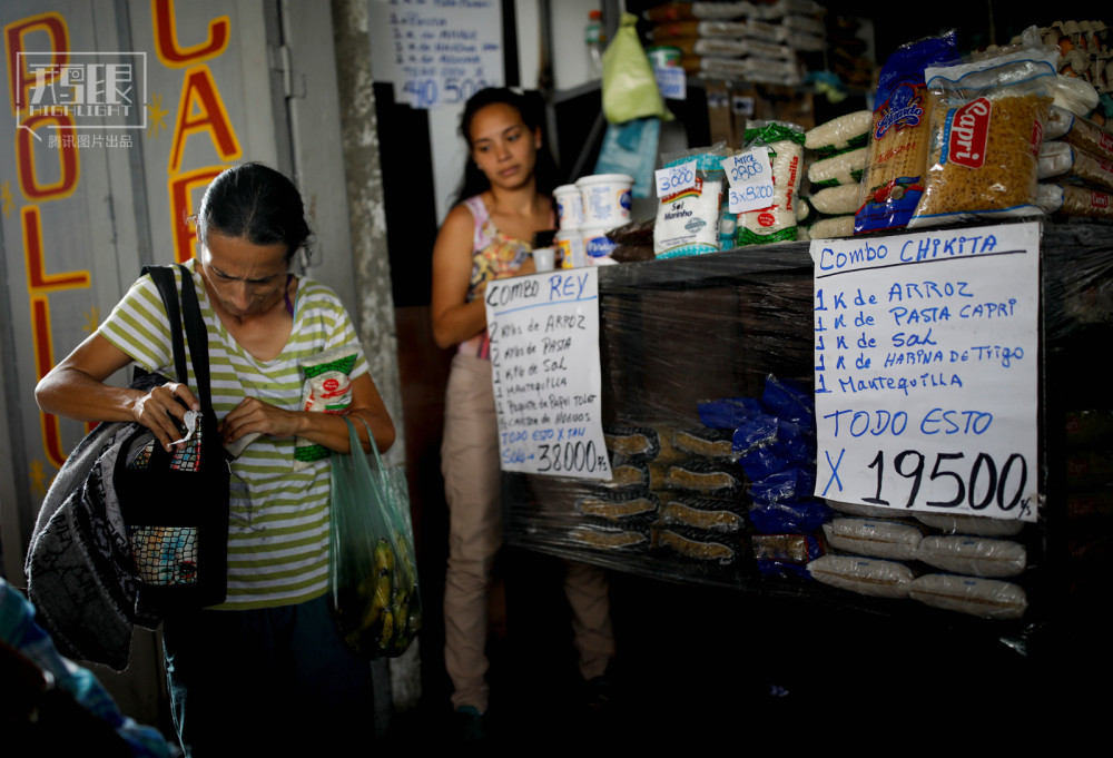 鹅眼:美女国度委内瑞拉,国民吃不饱严重营养不