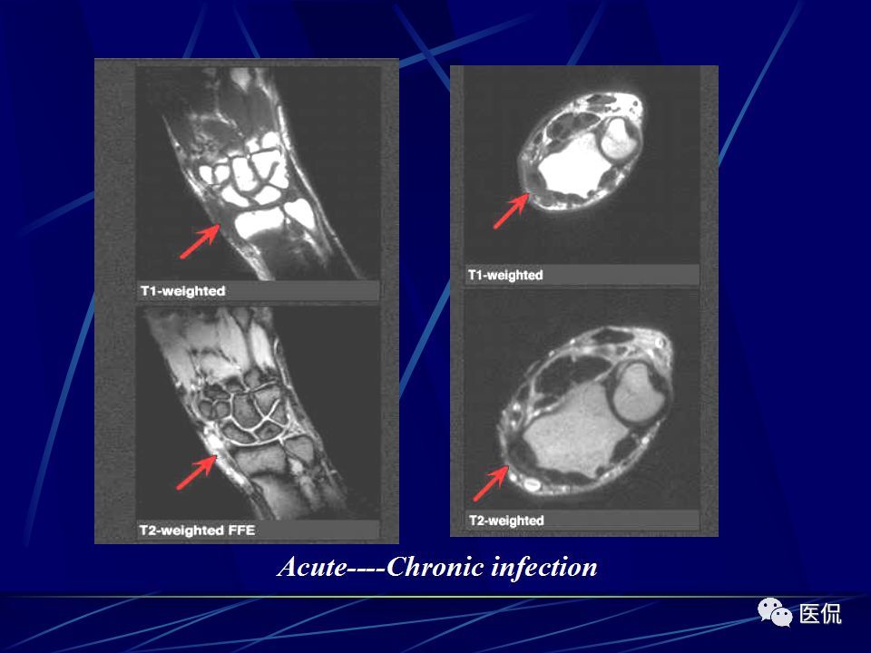 腕关节的mri解剖影像及诊断#医学影像经典ppt