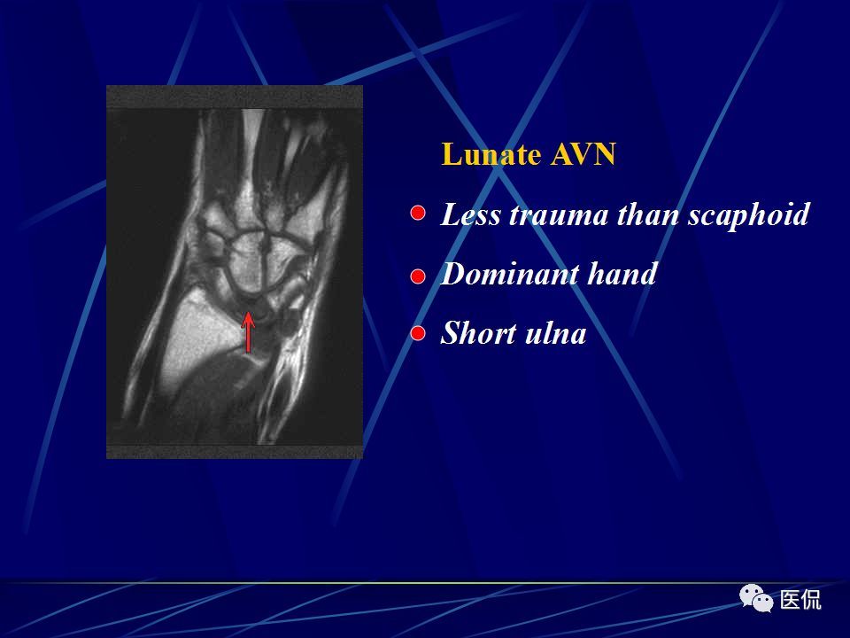 腕关节的mri解剖影像及诊断#医学影像经典ppt