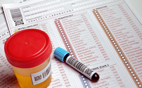 体检尿酸高,多喝苏打水能降尿酸吗?来看看医生