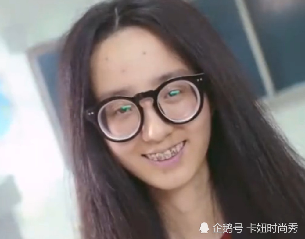 丑女班长因为带牙套被同学嘲笑,去医院取下牙套后,全