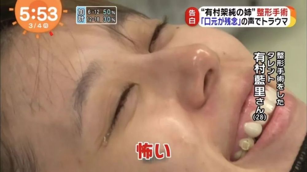 同样是整容 怎么他就被骂 看点快报