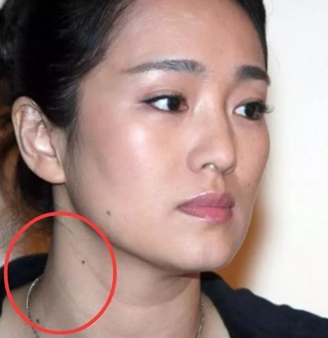 痣相:上佳的显痣,隐痣有哪些?显福显贵显财的好痣