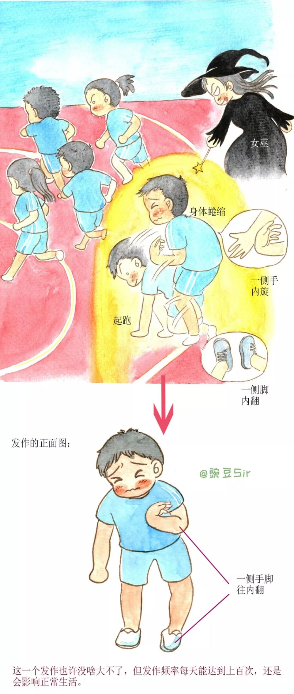 漫画科普:运动诱发运动障碍pkd的魔咒:我的身体不听话