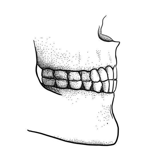 研究员们通过建立生物力学模型发现, 覆合牙型发f和v要比对切咬合牙型