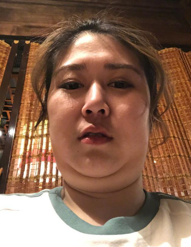 张雨绮晒与经纪人挑战双下巴自拍 太嘚瑟调皮了 毫无