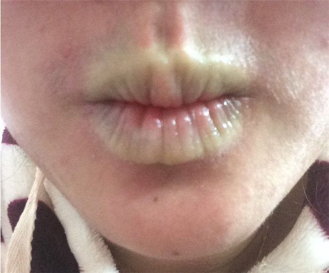 一言难尽的3种唇形 颜值瞬间跌剩一半 太难 救 了 看点快报