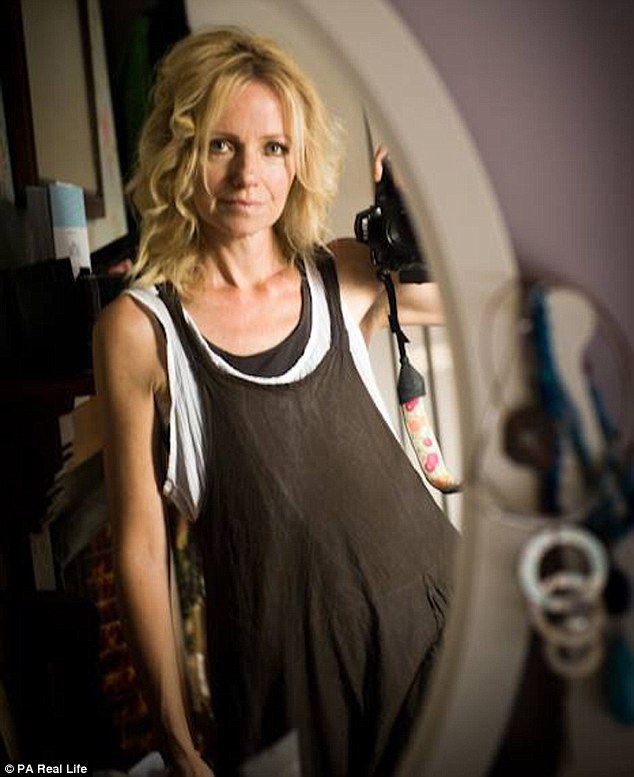 女子切除乳腺后拍“无胸”写真 微笑面对 (组图)