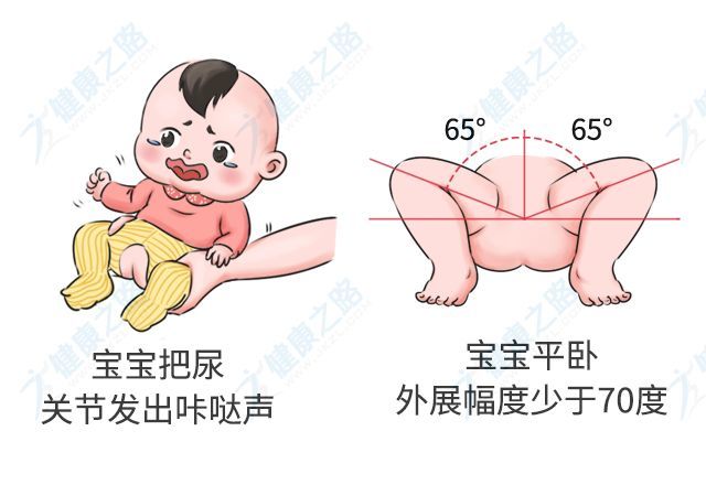 这种常见的儿童"骨骼畸形",很多家长没发现!医生4招教