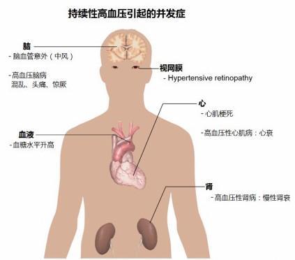 人口容量要素_人口容量思维导图(3)