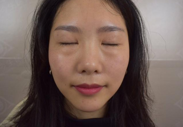 鱼尾纹,法令纹,抬头纹,眼角