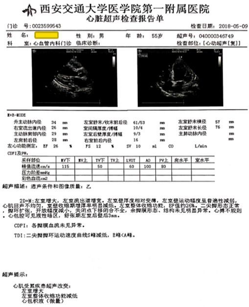 入院前门诊超声心动图检查结果