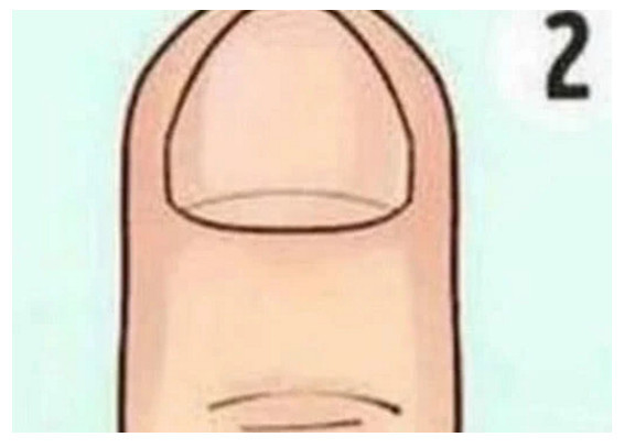 640